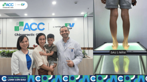 điều trị đúng thời điểm là chìa khóa bảo vệ hệ vận động tương lai của trẻ thumbnail