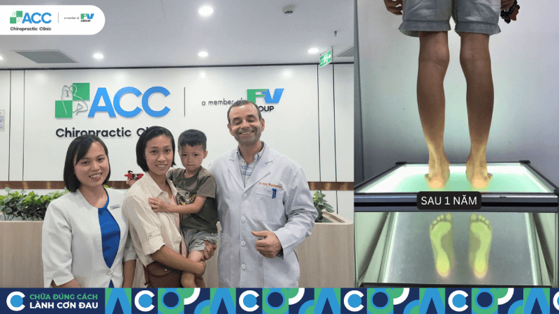 điều trị đúng thời điểm là chìa khóa bảo vệ hệ vận động tương lai của trẻ