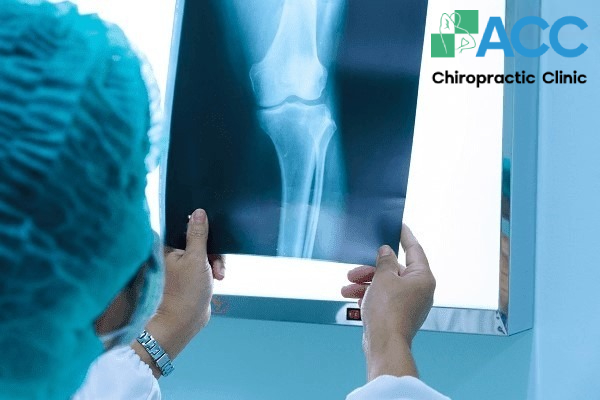 Làm sao để chẩn đoán thoái hóa khớp gối?