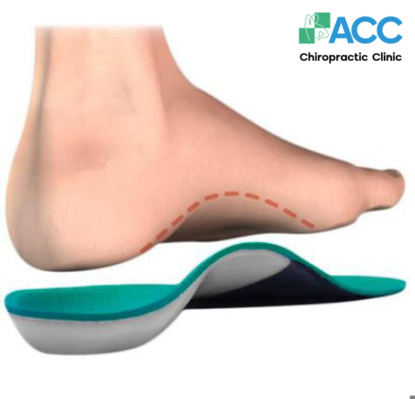 bàn chân bẹt ở trẻ có ảnh hưởng gì không