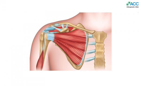 đau nhức khớp vai