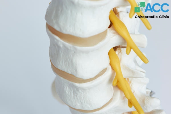 bệnh hẹp lỗ tiếp hợp cột sống cổ