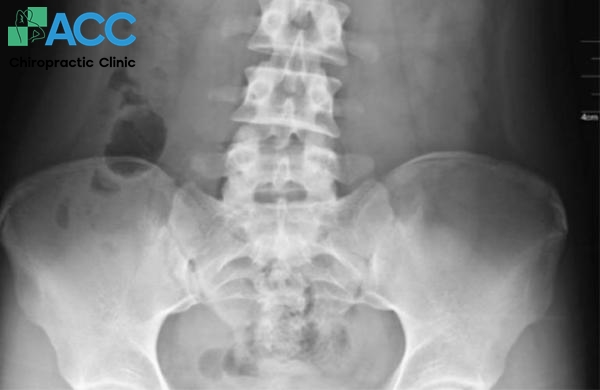 cách giảm đau cơ háng