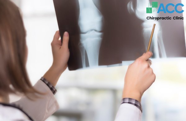 đầu gối bị sưng sau khi ngã