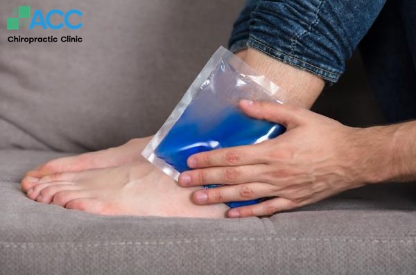 mẹo trị bong gân