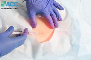 tiêm màng cứng thoát vị đĩa đệm có hại không