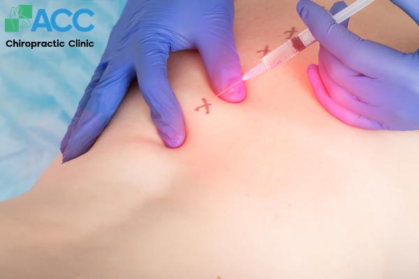 tiêm phong bế cột sống thoát vị đĩa đệm