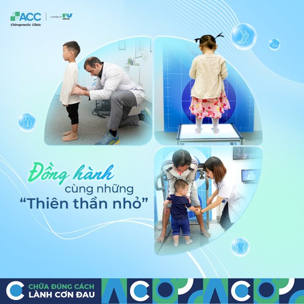 bàng giá điều trị bàn chân bẹt