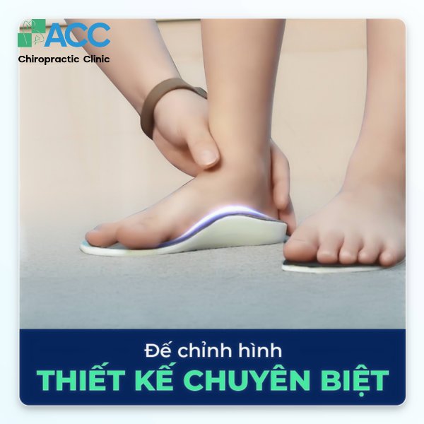 chữa bàn chân bẹt hết bao nhiêu tiên