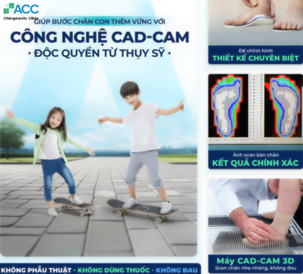 khám bàn chân bẹt tại tphcm