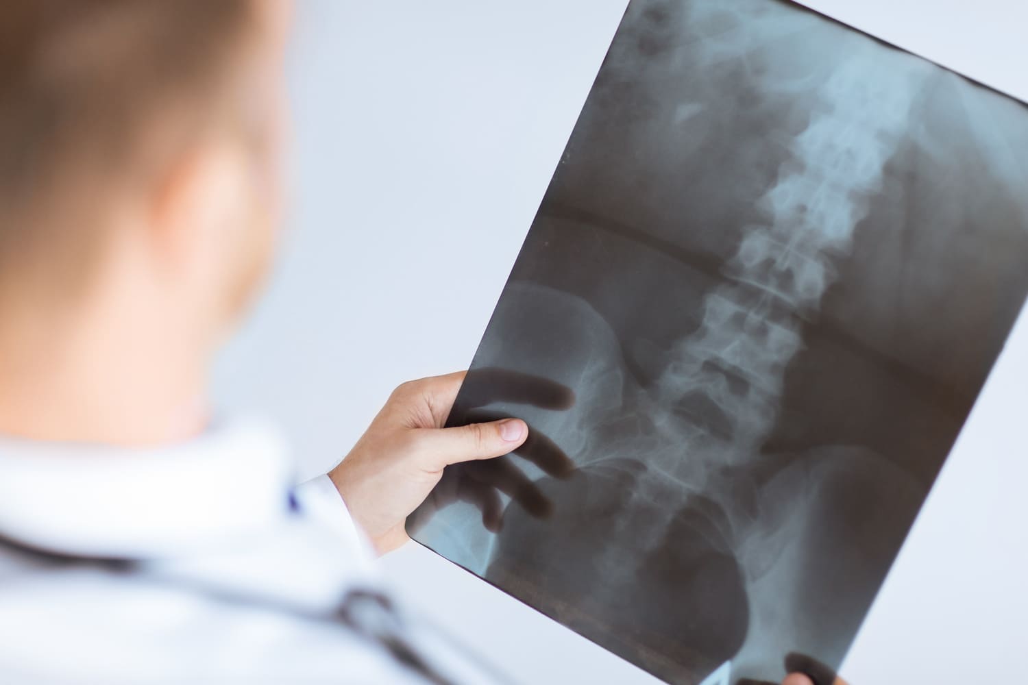 chẩn đoán hình ảnh giúp bác sĩ có cách trị thần kinh tọa phù hợp