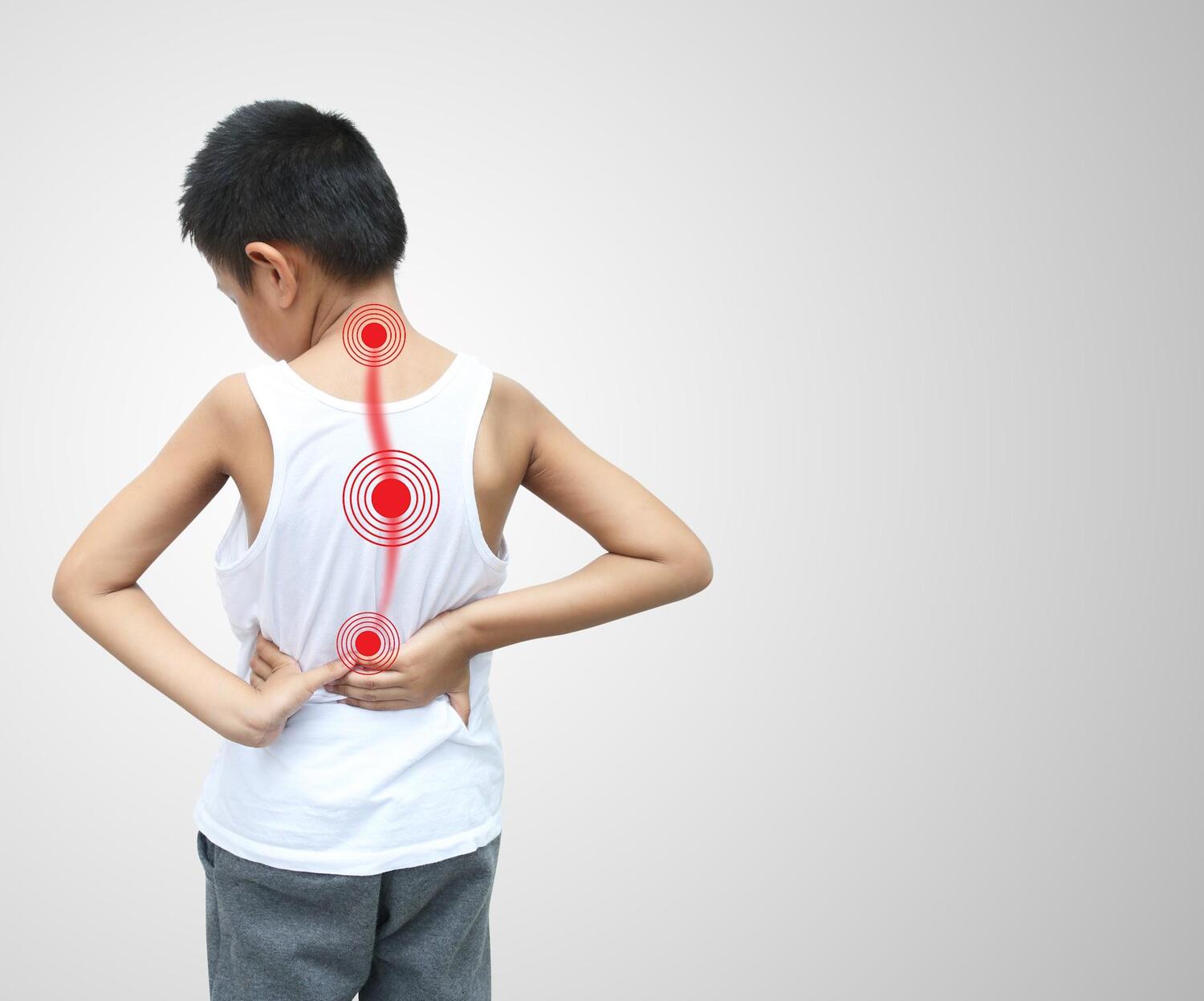 Hình ảnh trẻ bị lệch cột sống thường gặp