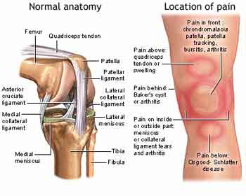 orthotics and knee pain