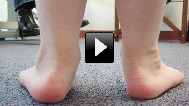 ACC English | Children And Foot Pain
